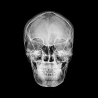 CHCĘ ZOSTAĆ MENELEM