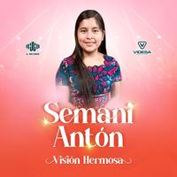 Visión Hermosa