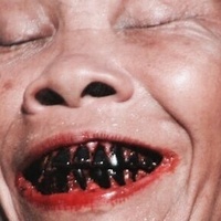 Hepatitis G