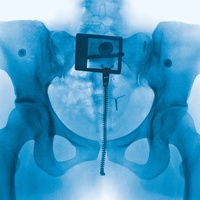 Sound image